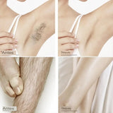 Spray de espuma depiladora