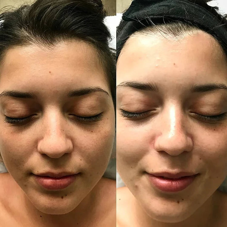 Crema Aclarante | ✨ Aclara tu Piel ✨ Resultados en una Semana!