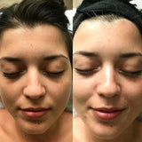 Crema Aclarante | ✨ Aclara tu Piel ✨ Resultados en una Semana!