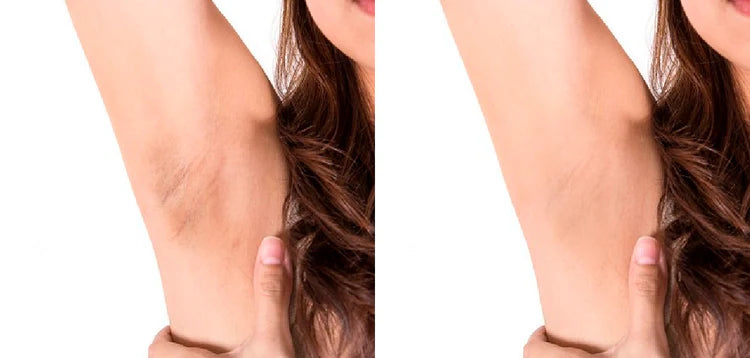 Crema Aclarante | ✨ Aclara tu Piel ✨ Resultados en una Semana!