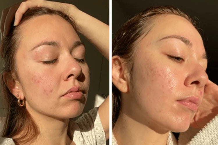 Crema Aclarante | ✨ Aclara tu Piel ✨ Resultados en una Semana!